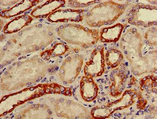 CYP11B2 Antibody