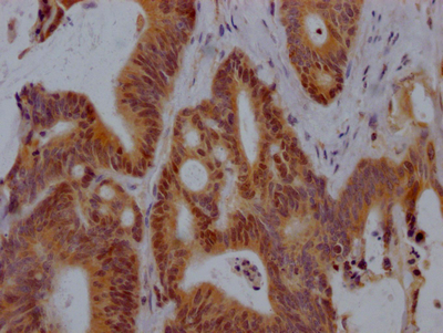 VDR Antibody