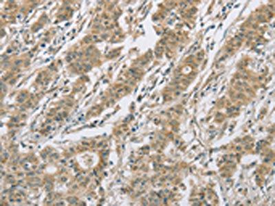CYP2C9 Antibody