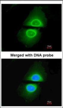 CYP4A11 Rabbit Polyclonal Antibody