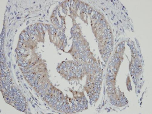 CYP4A11 Rabbit Polyclonal Antibody