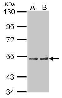 CYP4A11 Rabbit Polyclonal Antibody