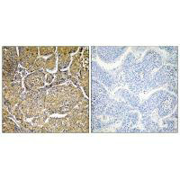 CYP8B1 Antibody