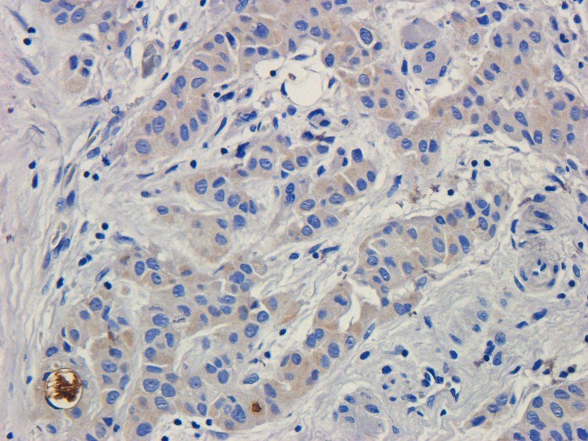 Cystatin C Mouse Monoclonal Antibody