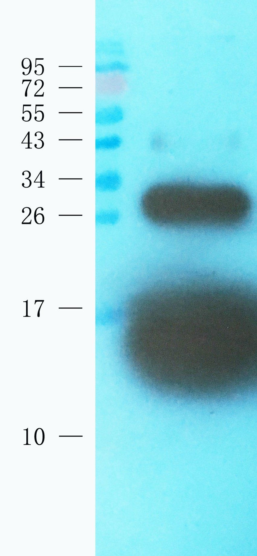 Cystatin C Mouse Monoclonal Antibody
