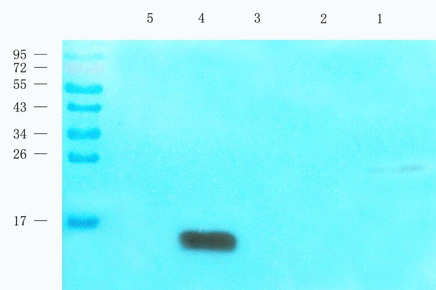 Cystatin C Mouse Monoclonal Antibody