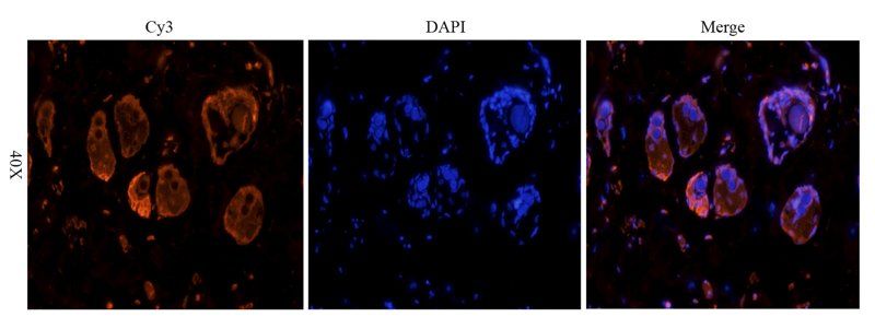 Cystatin C Rabbit Polyclonal Antibody