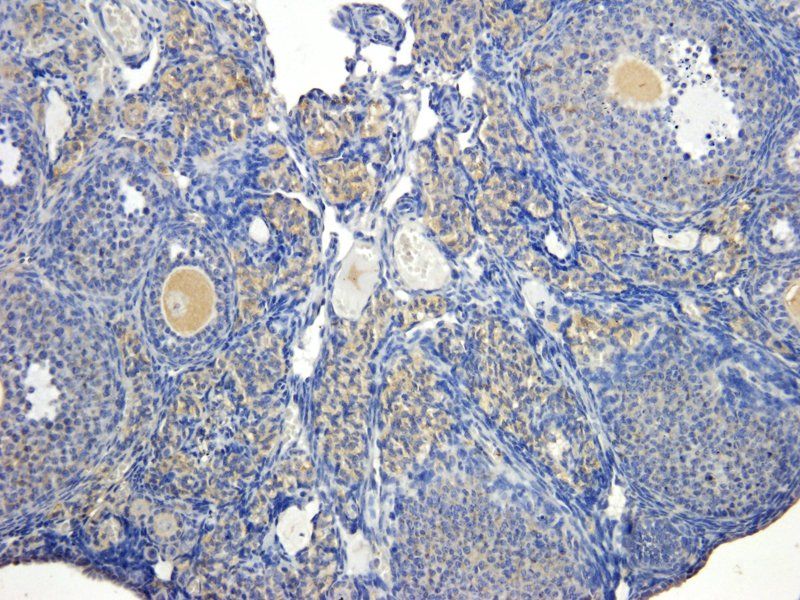 Cystatin C Rabbit Polyclonal Antibody