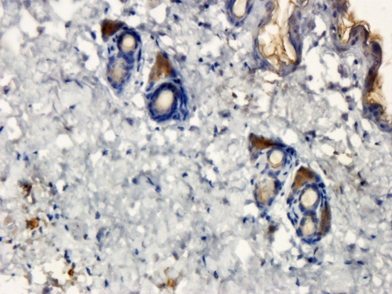 Cystatin C Rabbit Polyclonal Antibody