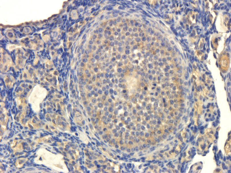 Cystatin C Rabbit Polyclonal Antibody