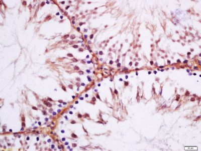 Cystatin SA Rabbit Polyclonal Antibody