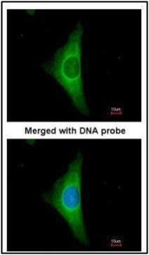 Cytokeratin 20 Rabbit Polyclonal Antibody