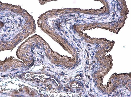 Cytokeratin 20 Rabbit Polyclonal Antibody