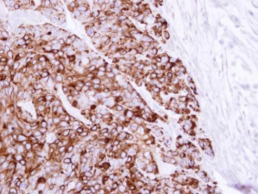 Cytokeratin 20 Rabbit Polyclonal Antibody