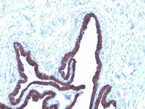 KRT8 Antibody