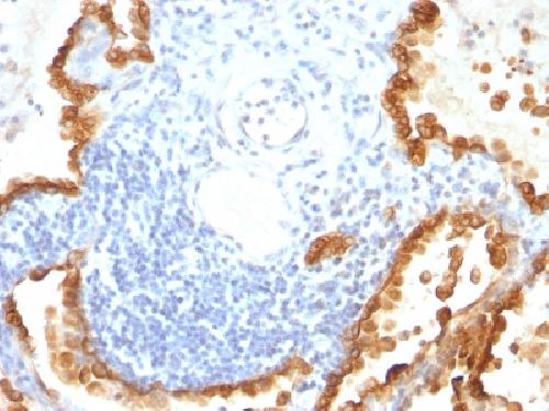 KRT8 Antibody