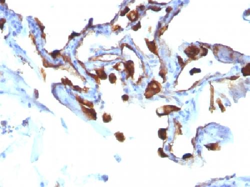KRT8 Antibody
