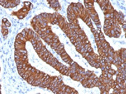 KRT8 Antibody