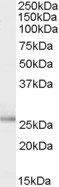 Goat anti-TPD52L1 / D53 Antibody