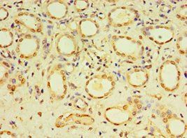 DACT3 Antibody