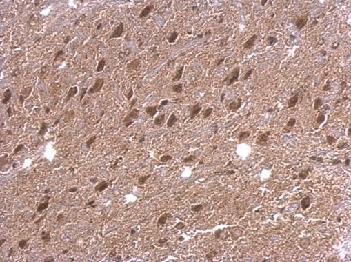 DAP5 Rabbit Polyclonal Antibody
