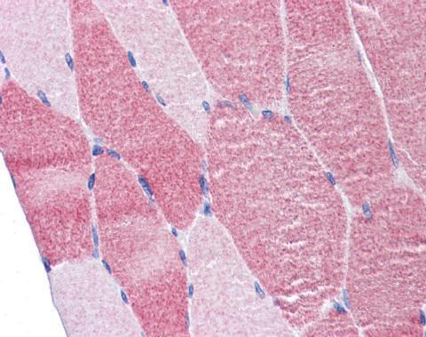 DAP5 Rabbit Polyclonal Antibody