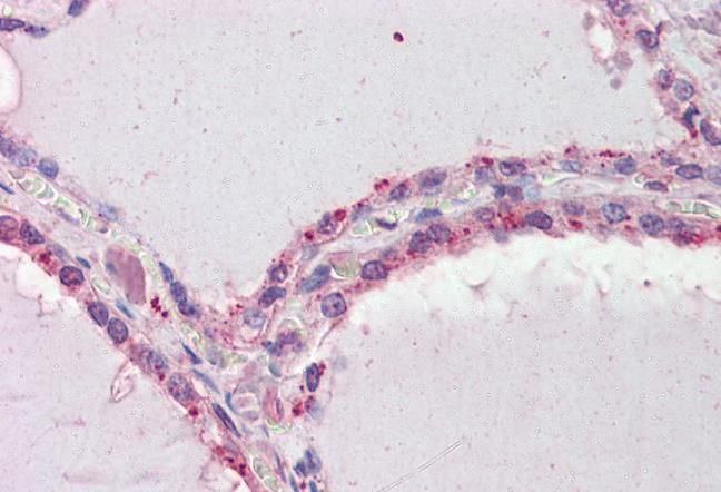 DAPK2 Antibody