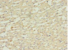 DAPK2 Antibody
