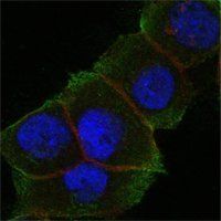 DAXX Antibody