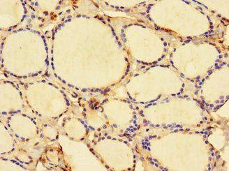 DBR1 Antibody