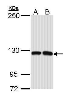 PPFIBP2 Rabbit Polyclonal Antibody