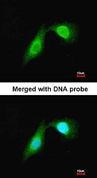 DCAMKL2 Rabbit Polyclonal Antibody