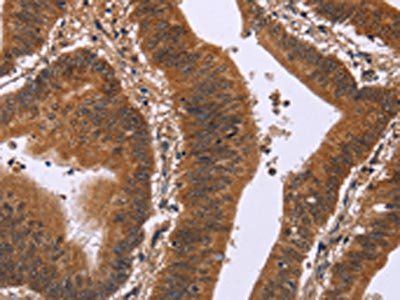 DCBLD2 Antibody