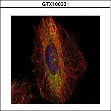 DCTN1 Rabbit Polyclonal Antibody