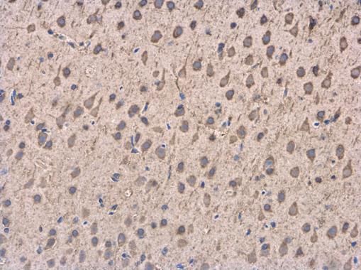DCTN1 Rabbit Polyclonal Antibody