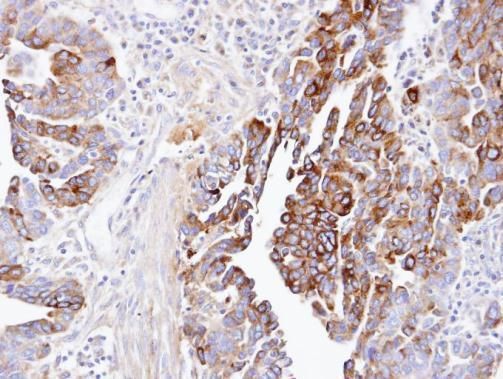 DCTN1 Rabbit Polyclonal Antibody