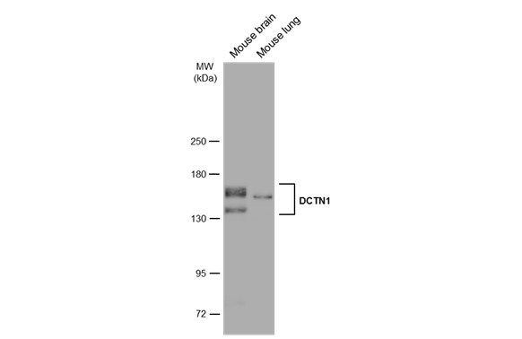 DCTN1 Rabbit Polyclonal Antibody