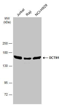 DCTN1 Rabbit Polyclonal Antibody