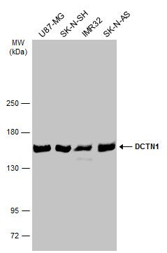 DCTN1 Rabbit Polyclonal Antibody