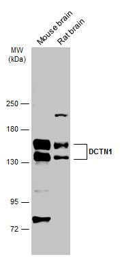 DCTN1 Rabbit Polyclonal Antibody