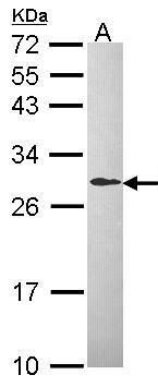 MAD2L1 Rabbit Polyclonal Antibody