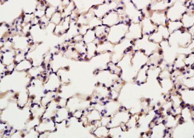 DDAH2 Rabbit Polyclonal Antibody