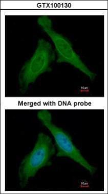 DDB1 Rabbit Polyclonal Antibody