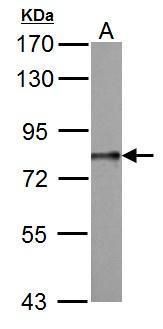 DDX3 Rabbit Polyclonal Antibody