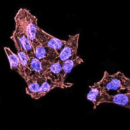 DDX39B Antibody