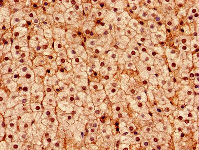 DDX3X Antibody