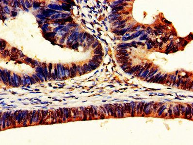 DDX3X Antibody