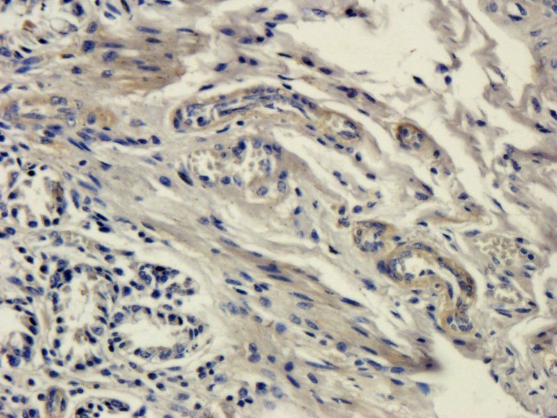 DDX4 Rabbit Polyclonal Antibody