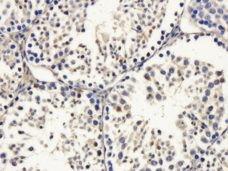 DDX4 Rabbit Polyclonal Antibody