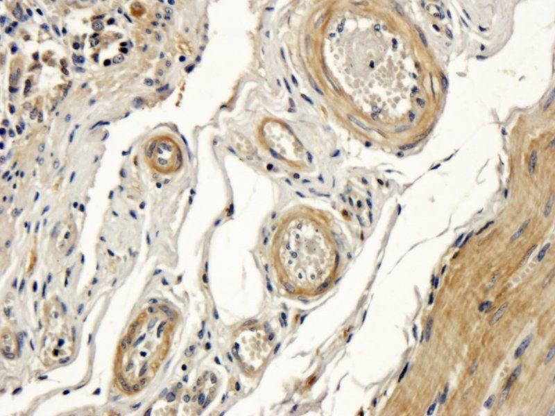 DDX4 Rabbit Polyclonal Antibody